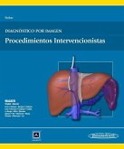 Diagnóstico por imagen : procedimientos intervencionistas