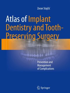 Atlas of Implant Dentistry and Tooth-Preserving Surgery - Stajcic, Zoran