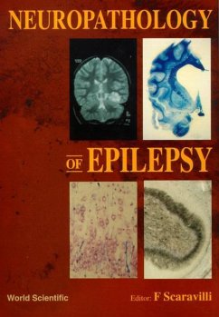 Neuropathology of Epilepsy