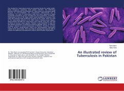 An illustrated review of Tuberculosis in Pakistan - Nazir, Taha;Taha, Nida