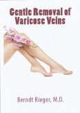 Gentle Removal of Varicose Veins (eBook, ePUB)