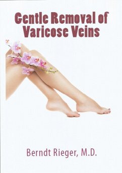 Gentle Removal of Varicose Veins (eBook, ePUB) - Rieger, Berndt