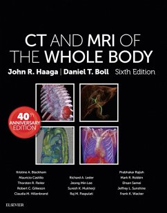 Cover Computed Tomography & Magnetic Resonance Imaging Of The Whole Body E-Book (eBook, ePUB)