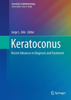 Keratoconus