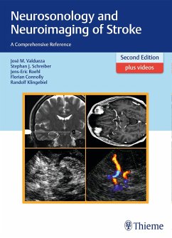 Neurosonology and Neuroimaging of Stroke - Valdueza, José Manuel; Schreiber, Stephan; Röhl, Jens-Eric; Connolly, Florian; Klingebiel, Randolf