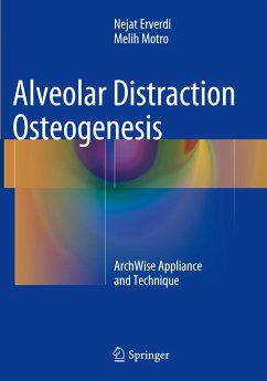 Alveolar Distraction Osteogenesis - Erverdi, Nejat;Motro, Melih