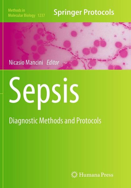 Sepsis Sepsis