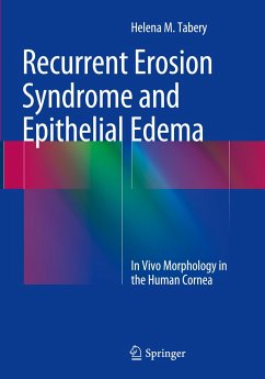 Recurrent Erosion Syndrome and Epithelial Edema - Tabery, Helena M.