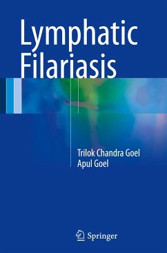 Lymphatic Filariasis - Goel, Trilok Chandra;Goel, Apul
