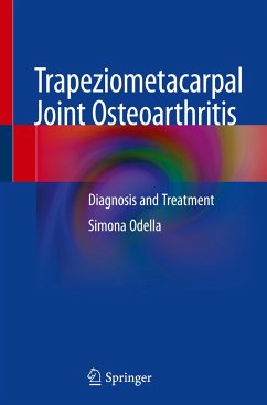 Trapeziometacarpal Joint Osteoarthritis - Odella, Simona