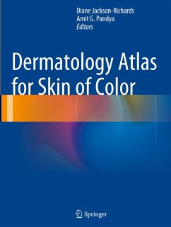 Dermatology Atlas for Skin of Color