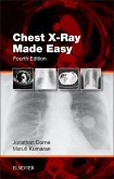 Chest X-Ray Made Easy E-Book (eBook, ePUB)