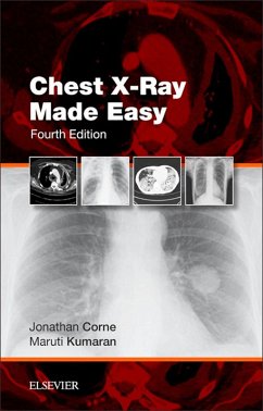 Cover Chest X-Ray Made Easy E-Book (eBook, ePUB)