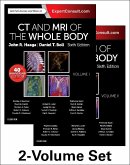 CT and MRI of the Whole Body, 2-Volume Set CT and MRI of the Whole Body, 2-Volume Set