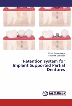 Retention system for Implant Supported Partial Dentures