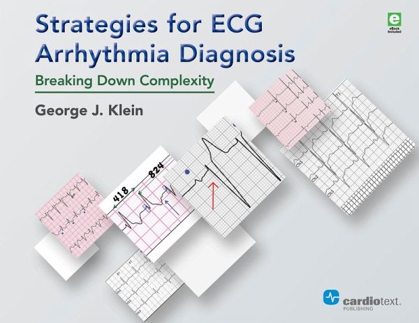 Strategies for ECG Arrhythmia Diagnosis (eBook, PDF) Strategies for ECG Arrhythmia Diagnosis (eBook, PDF)