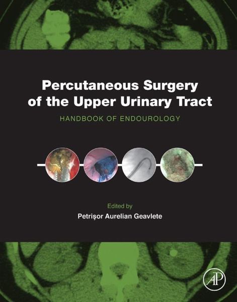 Percutaneous Surgery of the Upper Urinary Tract (eBook, ePUB)