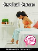 Cervical Cancer (eBook, ePUB)