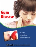 Gum Disease (eBook, ePUB)