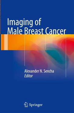 Imaging of Male Breast Cancer