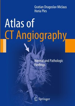 Atlas of CT Angiography - Miclaus, Gratian;Ples, Horia