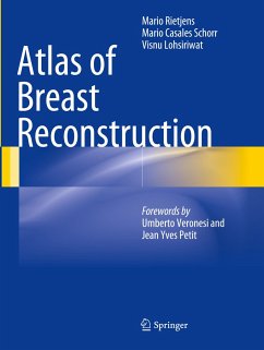 Atlas of Breast Reconstruction - Rietjens, Mario;Casales Schorr, Mario;Lohsiriwat, Visnu