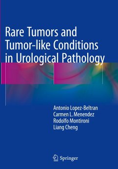 Rare Tumors and Tumor-like Conditions in Urological Pathology - Lopez-Beltran, Antonio;Menendez, Carmen L.;Montironi, Rodolfo