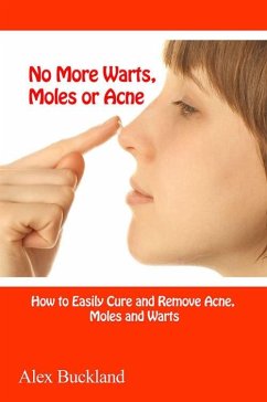 No More Warts, Moles or Acne (eBook, ePUB) - Buckland, Alex