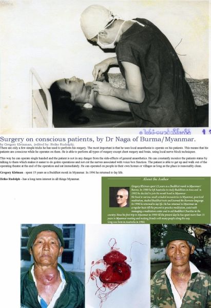 Surgery On Conscious Patients by Dr Naga of Burma (eBook, ePUB)