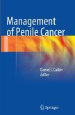 Management of Penile Cancer
