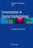 Cementation in Dental Implantology