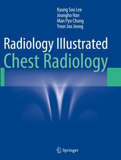 Radiology Illustrated: Chest Radiology - Lee, Kyung Soo;Han, Joungho;Chung, Man Pyo