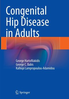 Congenital Hip Disease in Adults - Hartofilakidis, George;Babis, George C.;Lampropoulou-Adamidou, Kalliopi