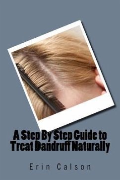 A Step By Step Guide to Treat Dandruff Naturally - Calson, Erin