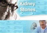 51 Tips for Dealing Kidney Stones (eBook, PDF)