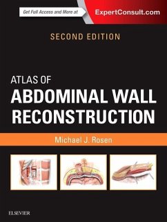 Atlas of Abdominal Wall Reconstruction - Rosen, Michael J.