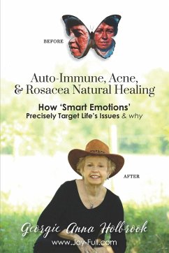 Auto-Immune, Acne, & Rosacea Natural Healing - How 'Smart Emotions' Precisely Target Life's Issues & Why - Holbrook, Georgie Anna