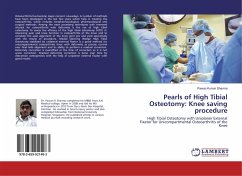 Pearls of High Tibial Osteotomy: Knee saving procedure - Sharma, Pawan Kumar