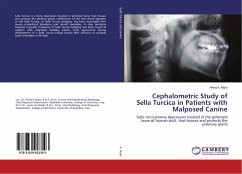 Cephalometric Study of Sella Turcica in Patients with Malposed Canine