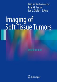 Imaging of Soft Tissue Tumors