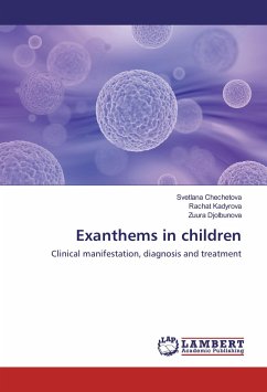 Exanthems in children