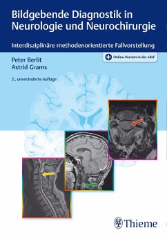 Bildgebende Diagnostik in Neurologie und Neurochirurgie - Berlit, Peter;Grams, Astrid
