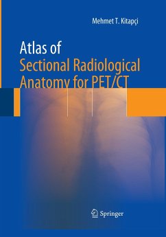 Atlas of Sectional Radiological Anatomy for PET/CT - Kitapci, Mehmet T.
