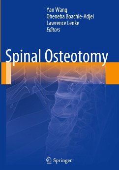 Spinal Osteotomy