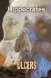 Ulcers (eBook, ePUB) - Bild 1