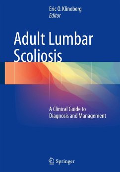 Adult Lumbar Scoliosis