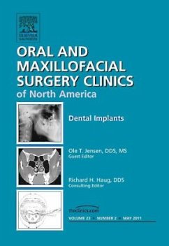 Dental Implants, An Issue of Oral and Maxillofacial Surgery Clinics - Jensen, Ole