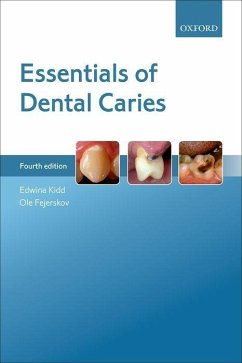 Essentials of Dental Caries - Kidd, Edwina (Emerita Professor of Cariology, Emerita Professor of C; Fejerskov, Ole (Professor Emeritus, Professor Emeritus, Institute of