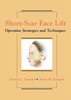Short-Scar Face Lift - Tonnard, Patrick;Verpaele, Alexis