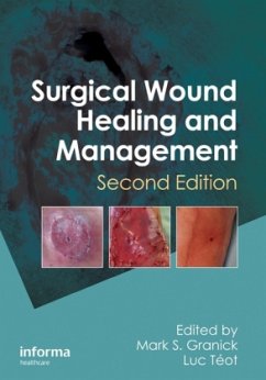 Surgical Wound Healing and Management